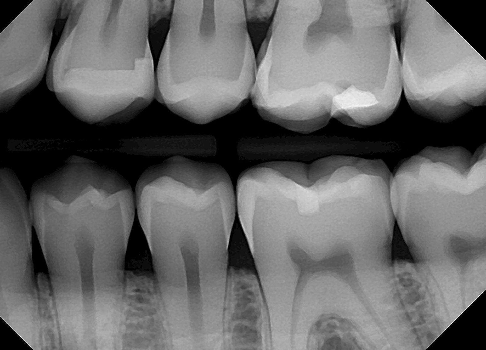 Dental X-Rays for Kids in Ahmedabad | Safe Pediatric Imaging